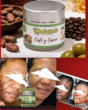 salud y belleza - CREMA ACLARANTE HADASSAH
